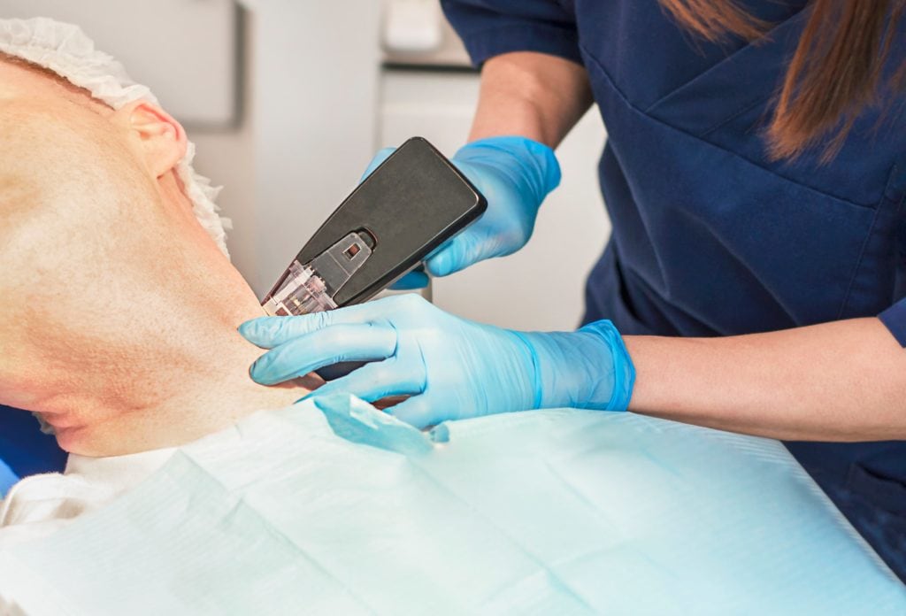 WHAT IS MORPHEUS8, AND WHAT CAN IT DO FOR YOUR SKIN?