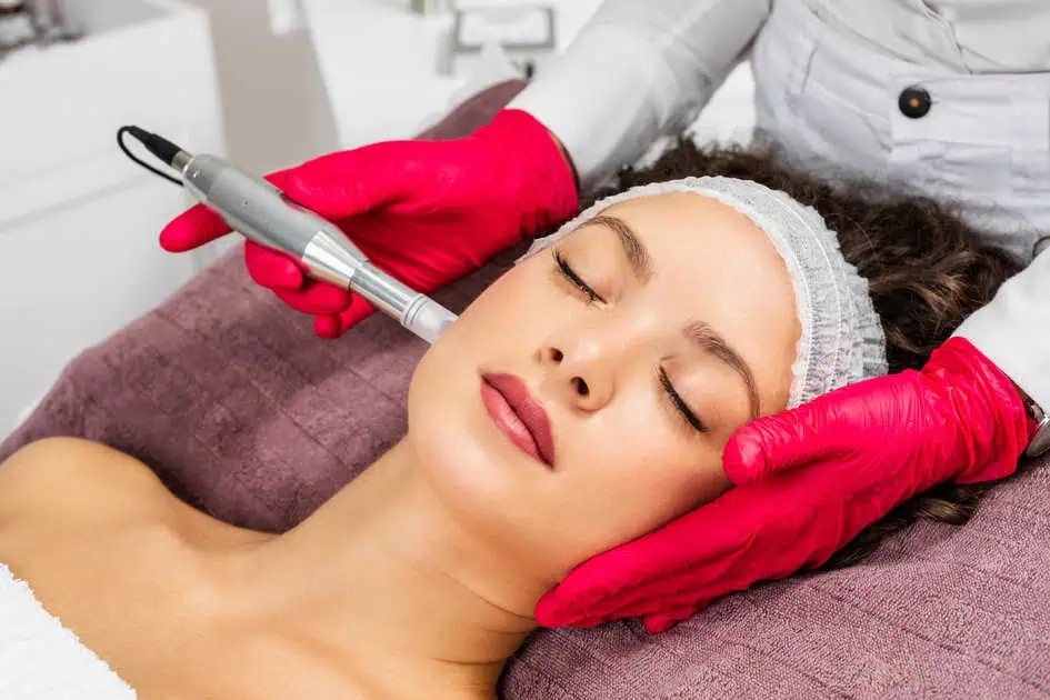 Microneedling by Skin Envy INC DBA Skin Envy Cosmetic and Laser Center in Brooklyn, NY 11209, United States