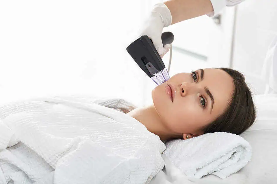 Morpheus8 Treatment In Brooklyn, NY by Skin Envy