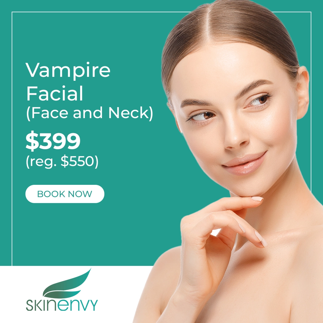 Skinenvy Vampire facial