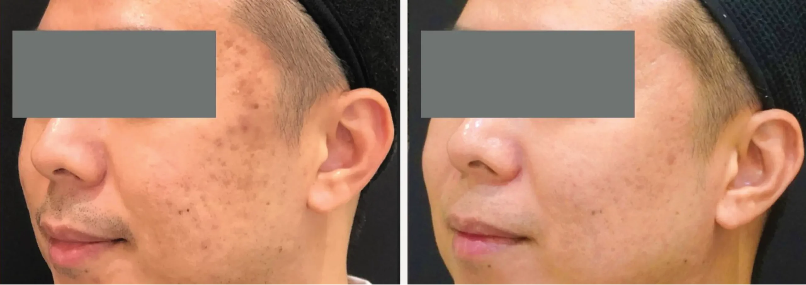 Face and Neck 2 1 scaled