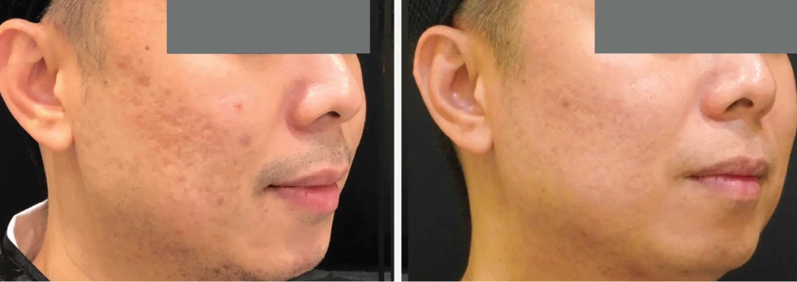 Face and Neck 3 1 scaled