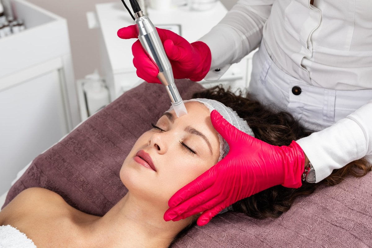 How AquaGold Microneedling Can Benefit Your Skin